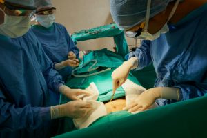 cirurgias do aparelho digestivo