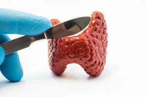 tireoidectomia total